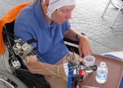 Guanto hi-tech consente ai disabili di muovere le mani e mangiare da soli