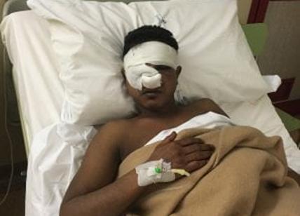 Bengalese pestato a sangue, resta il carcere l'aggressore 19enne