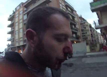 Giornalista aggredito da Roberto Spada: dopo l'intervista gli rompe il naso