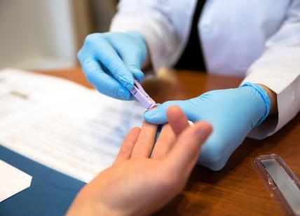 HIV, test gratis e anonimo allo Spallanzani: il risultato in appena 20 minuti