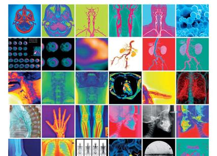Il linguaggio dell'arte spiega l'imaging diagnostico, la mostra
