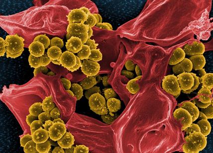 Superbatterio resiste agli antibiotici. Mycoplasma genitalium: SINTOMI