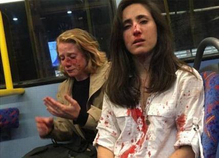 Londra, coppia lesbica picchiata su bus da uomini. "Volevano ci baciassimo"