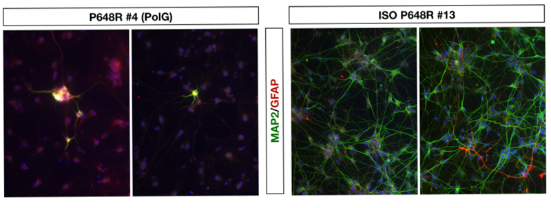 Differenziamento di Neuroni da precursori neuronali da linee Portatrici della mutazione POLG. I precursori della mutazione non sono in grado di differenziare in neuroni post-mitotici. Al contrario le cellule con mutazione corretta riacquistano la capacità di generare neuroni post-mitotici. Differenziamento di Neuroni da precursori neuronali da linee Portatrici della mutazione POLG. I precursori della mutazione non sono in grado di differenziare in neuroni post-mitotici. Al contrario le cellule con mutazione corretta riacquistano la capacità di generare neuroni post-mitotici.