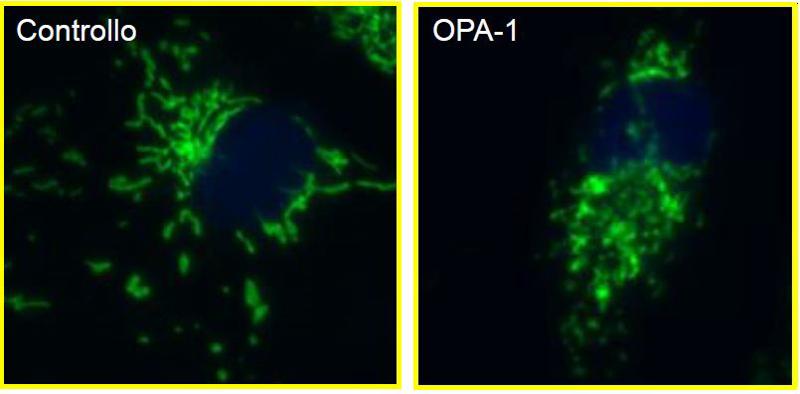 Cellule di controllo e cellule mutate nel gene OPA-1 decorate con il marcatore mitocondriale Mitotracker. A dimostrazione un alto livello di frammentazione mitocondriale nelle cellule mutate nel gene OPA-1 Cellule di controllo e cellule mutate nel gene OPA-1 decorate con il marcatore mitocondriale Mitotracker. A dimostrazione un alto livello di frammentazione mitocondriale nelle cellule mutate nel gene OPA-1