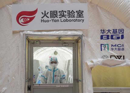 Coronavirus, dopo la Russia anche la Cina registra il suo primo vaccino