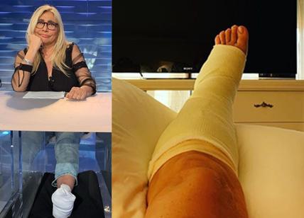 Ascolti tv, Mara Venier regina del day time con il piede fratturato