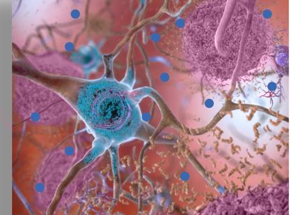 Alzheimer, scoperto un nuovo farmaco. Lo studio del Cnr
