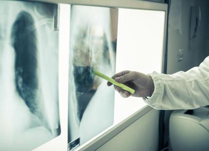Tumore del polmone: le terapie a bersaglio molecolare aprono nuove strade