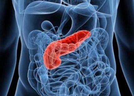 Tumore al pancreas: ecco quali sono i sintomi da non sottovalutare