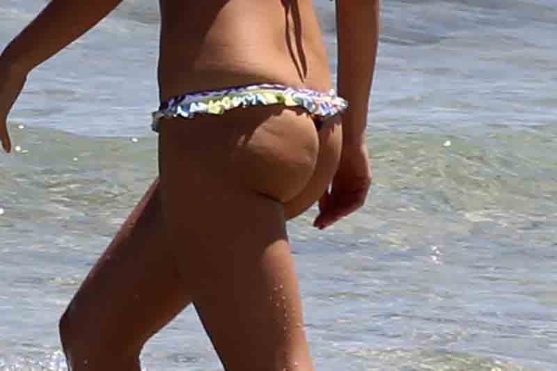 cellulite (8)