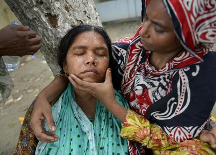 Bangladesh, Il 61% di chi lavora la pelle ha problemi di salute
