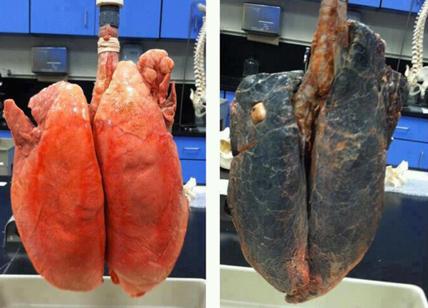 L'aria avvelenata uccide più dei tumori. Fumo e smog, per i polmoni non c'è scampo