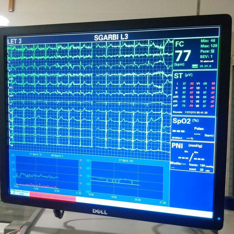 sgarbi elettrocardiogramm sgarbi elettrocardiogramm