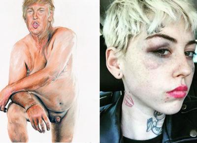 trump micropene illma gore