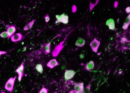 Scienza: sei nevrotico? Occhio al Parkinson, dice il Cnr