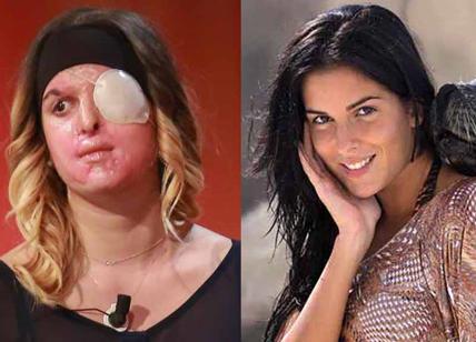 Gessica Notaro, la miss sfregiata con l'acido, mostra il suo volto in tv. Foto