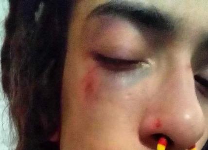Omofobia, 17enne aggredito a Baggio. Colpito con sassi, calci e pugni