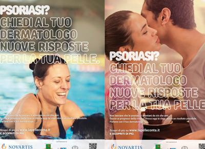 psoriasi ok