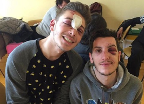 Aggressione omofoba: le due vittime Aggressione omofoba: le due vittime