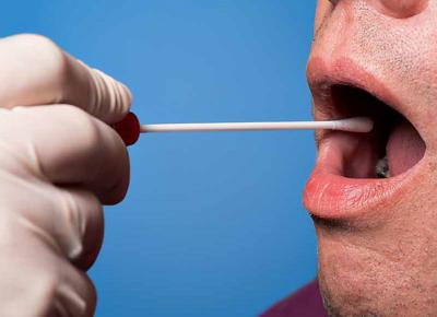 test salivare hiv