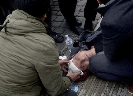 Erdogan in visita a Roma. Scontri durante sit-in: ferito un manifestante