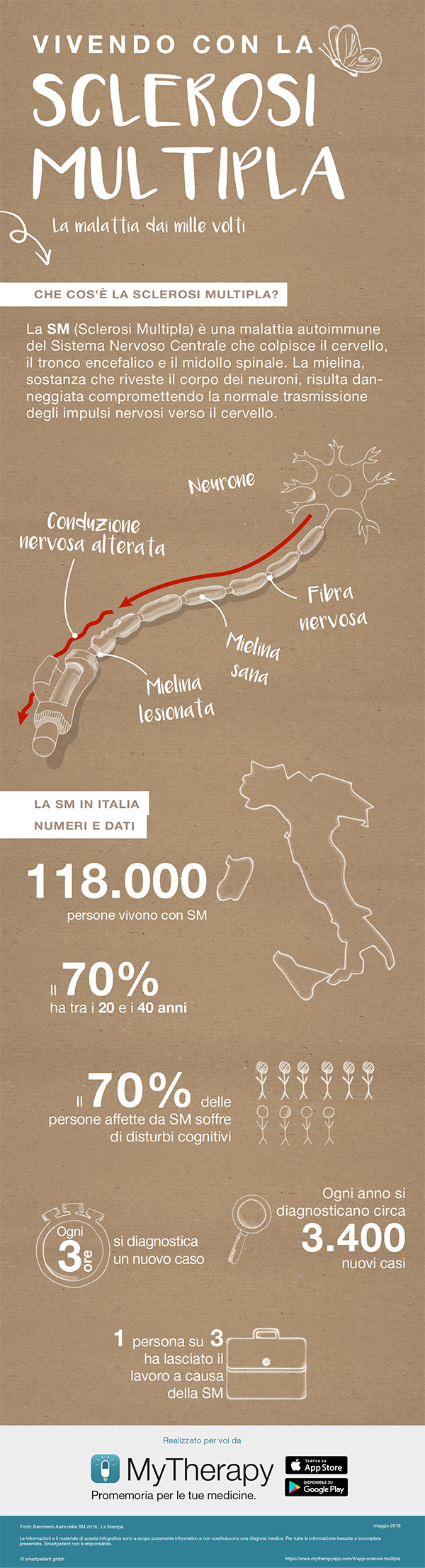 Infografica Sclerosi Multipla