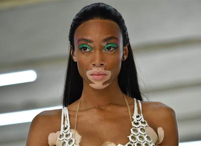 Winnie Harlow ape 2