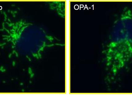 Parkinson, è lombarda la ricerca sulle super cellule in grado di contrastarlo Parkinson, è lombarda la ricerca sulle super cellule in grado di contrastarlo