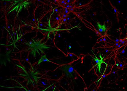 Patologie neurologiche e oncologiche, in Lombardia allo studio nuovi farmaci