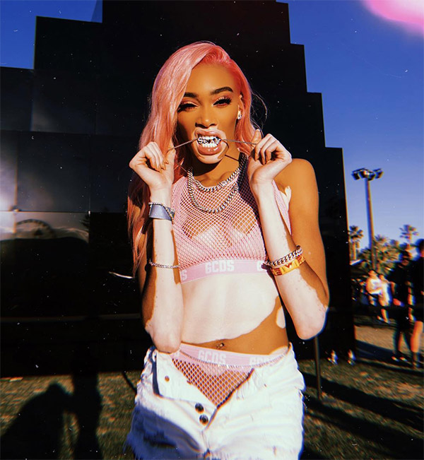 Foto Instagram Winnie Harlow Foto Instagram Winnie Harlow