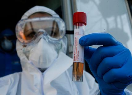 Coronavirus: contagio in base al gruppo sanguigno?