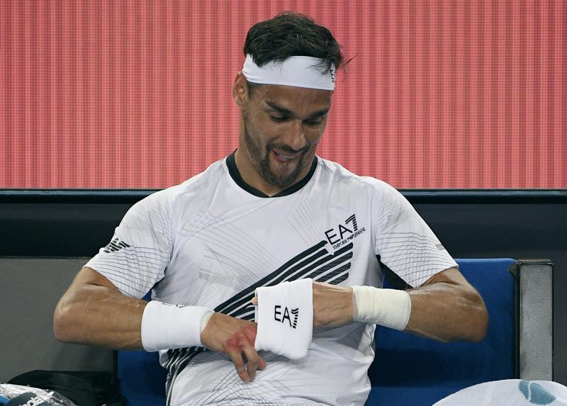FABIO FOGNINI (Lapresse) FABIO FOGNINI (Lapresse)