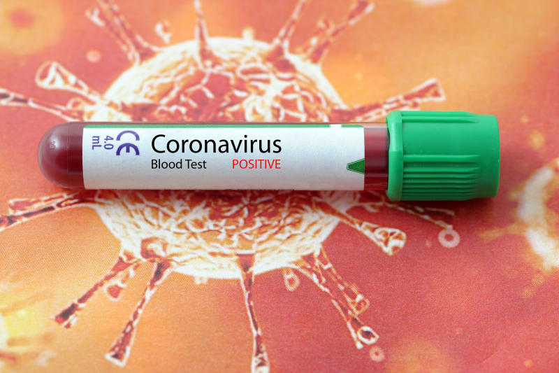 coronavirus covid