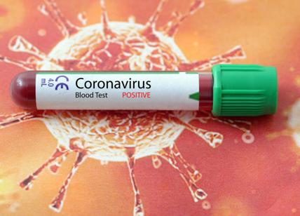 Coronavirus: quasi 1.900 contagi, 17 morti. Terapie intensive su