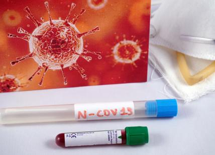 Coronavirus, il bollettino: 129 contagi e 15 morti nelle ultime 24 ore