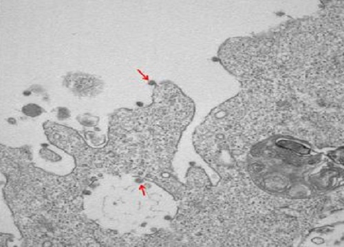 Coronavirus: le primi immagini del ceppo milanese Coronavirus: le primi immagini del ceppo milanese
