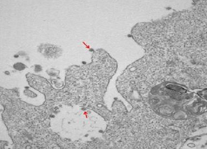 Coronavirus, ecco le prime immagini al microscopio del virus isolato al Sacco