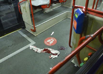 Milano, 23enne accoltellato da gang di sudamericani sul bus