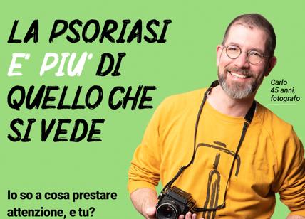 Novartis lancia la campagna: “La Psoriasi è più di quello che si vede”