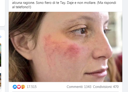Figlia di Calenda picchiata a Parigi dalla polizia durante una manifestazione