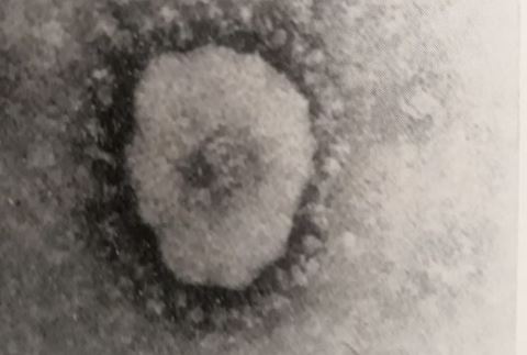 Foto inedita del coronavirus di Franco Pio Dicembre