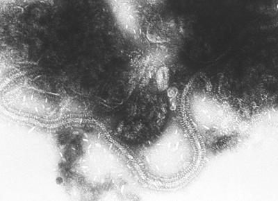 Respiratory syncytial virus