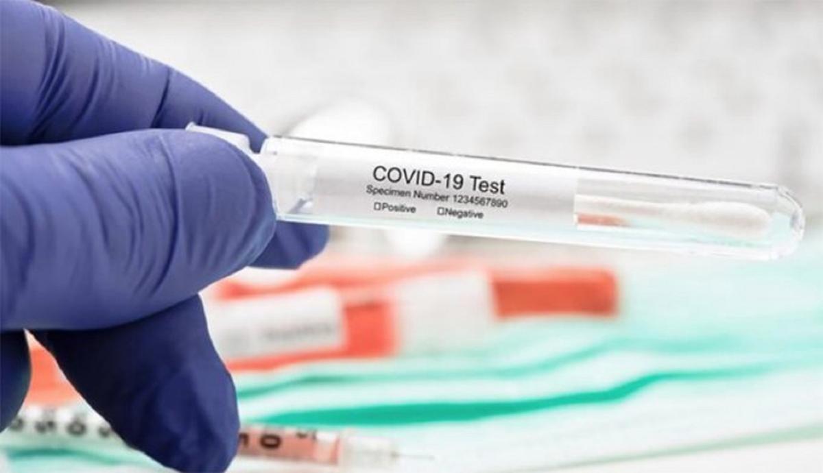 Test Covid et grippe : nouvelle solution rapide pour identifier les deux virus