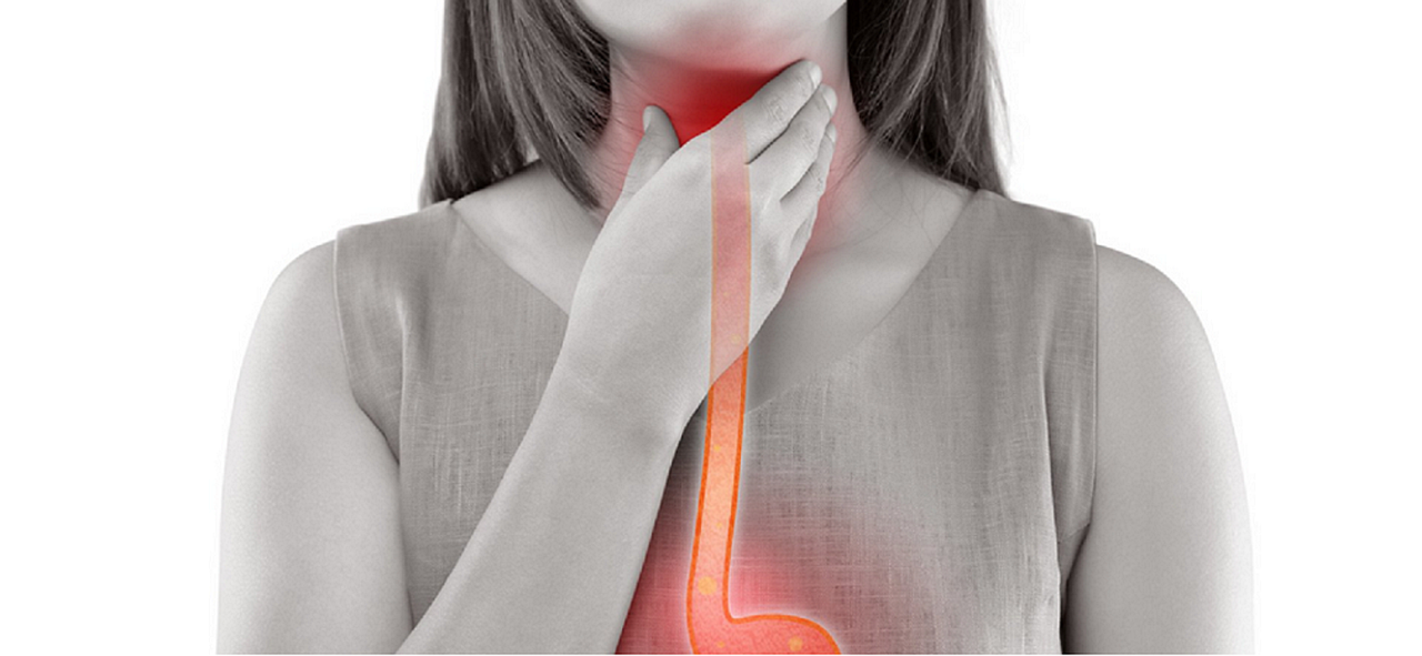 Reflusso gastroesofageo, rimedi, cause e sintomi