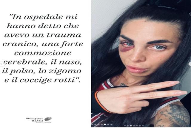 Francesca aggressione Milano Ig Francesca aggressione Milano Ig
