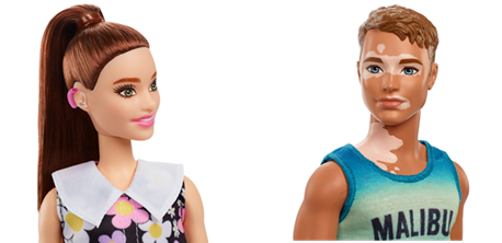 Barbie, arriva la prima bambola con apparecchio acustico