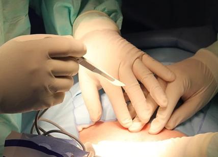 Asportato un tumore di 70 kg a una donna. Le Mollette: "È un miracolo"