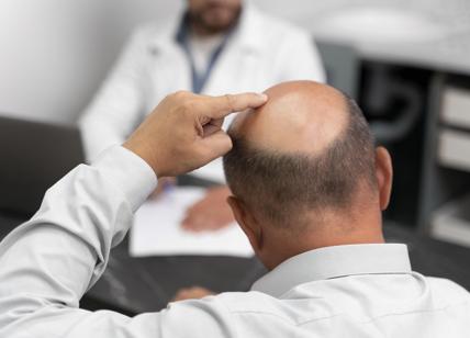 Caduta capelli cause: 9 possibili ragioni per la perdita della chioma