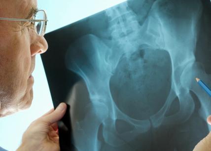 Osteoporosi: dalla prevenzione alla diagnosi